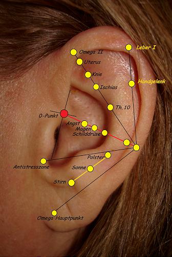 140. Sterilität, links