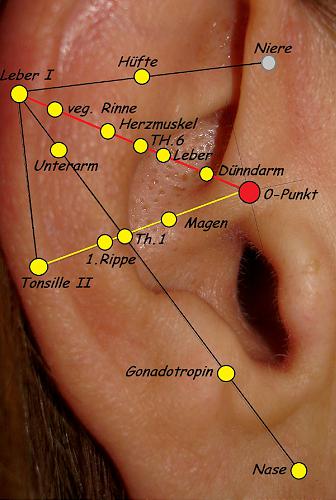 143. Impotenz, rechts