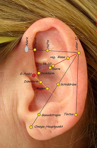 146. Hyperemesis, links