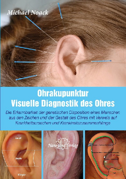 Ohrakupunktur-Visuelle-Diagnostik-des-Ohres-Michael-Noack.23442